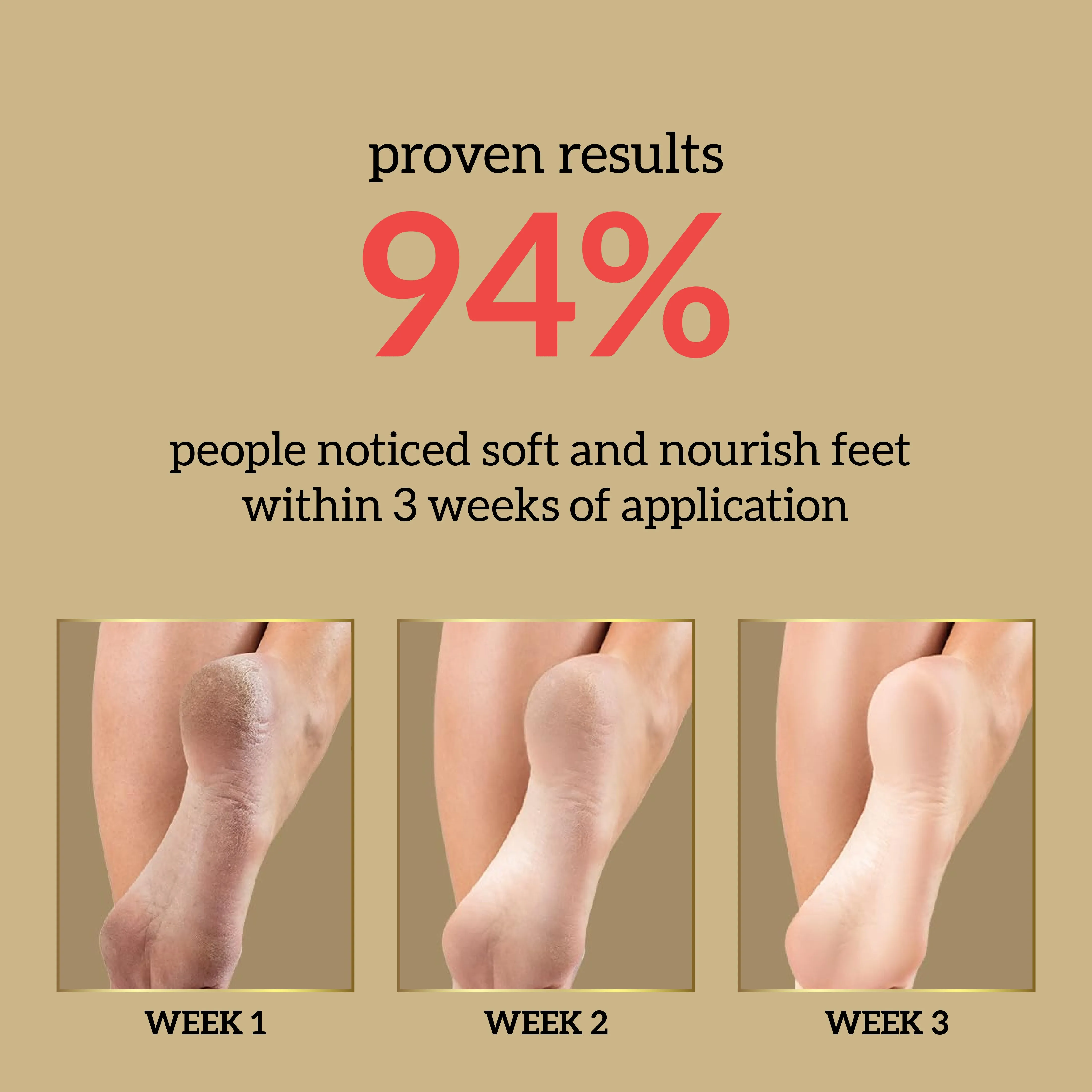 Shea Butter Foot Cream - 50g